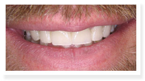Colorado Alpine Dentists patient photo 5