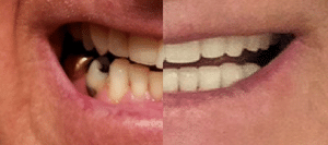 Colorado Alpine Dentists patient photo 1